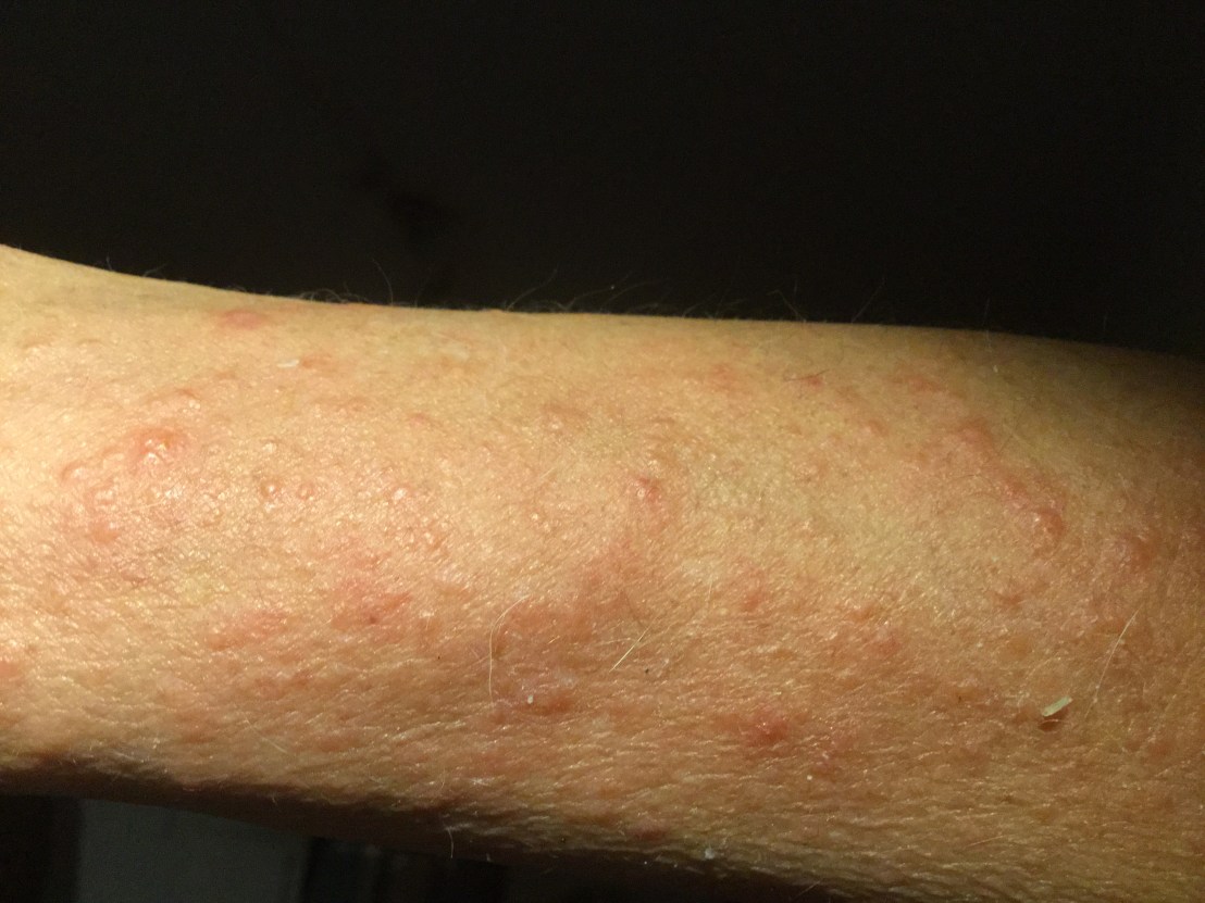 E0C58935-570D-4623-B6A3-3BC6C4644FB0